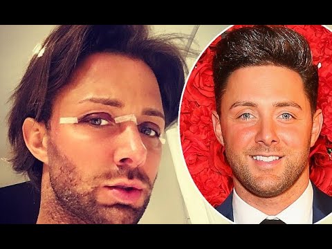 Former Geordie Shore star Ricci Guarnaccio shows off surgery results