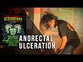 Anorectal Ulceration - Live at Blackblood 13 #SuarKeBachhe