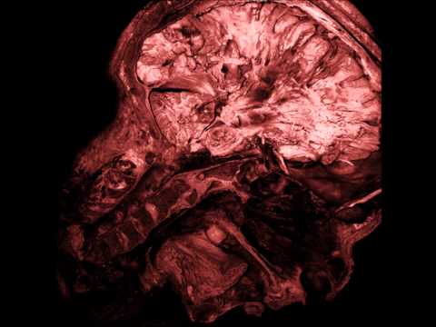 Thanatopsis - Another Perspective Of Death