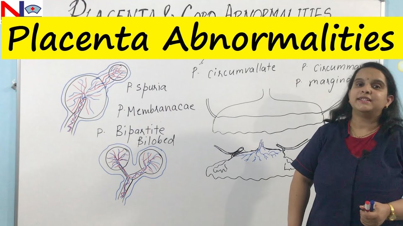 What causes an abnormally large placenta? Ref Tips