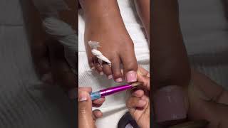 Acrylic Toes!😱🦶🏽✨#nails #acrylicnails #frenchnails #nailtech #naildesigns #newvideo #nailart #wow