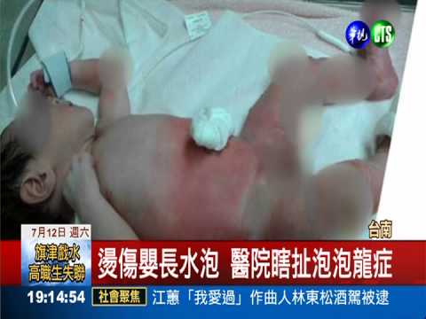 燙傷嬰還騙泡泡龍 家屬怒嗆醫院