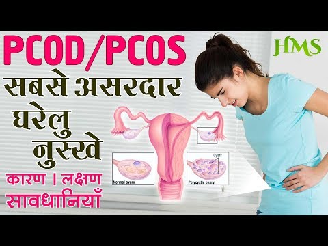 PCOS / PCOD के असरदार  घरेलू उपचार | How to treat Poly cystic Ovarian Syndrome with Home Remedies Video