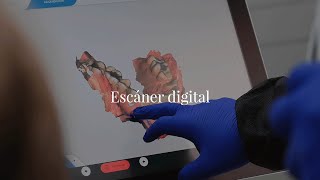 Escáner digital - Dental Corbella Ortega y Gasset