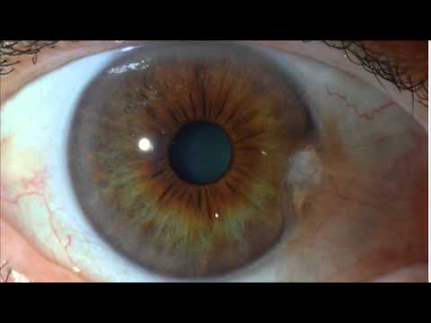 Hay Que Decirlo 09-30-15 (04) - Como prevenir el Alzheimer con el ayuno sustentado