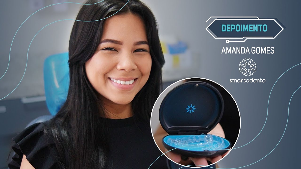 APARELHO INVISÍVEL - VALE A PENA?