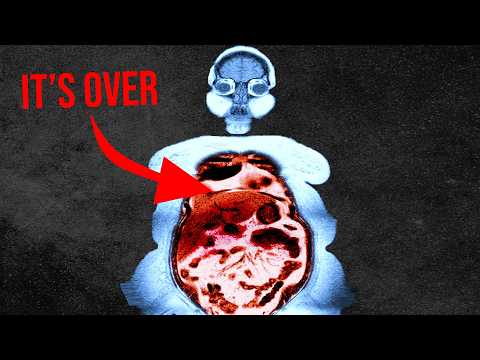 "I took my friend's weight-loss medicine, now my body hurts"