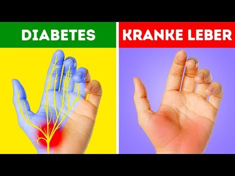 Vorgeschriebenen JUnidoks soljutab Prostatitis Nebenwirkungen Prostatamassage.