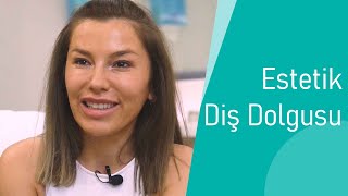 Estetik Diş Dolgusu, Yorumlar, Düzenli Diş Hekimi Ziyaretinin Önemi | Dentway De