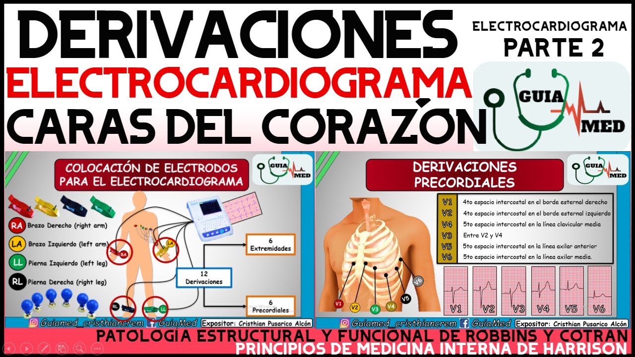 DERIVACIONES ELECTROCARDIOGRAMA Y CARAS DEL CORAZÓN | GuiaMed