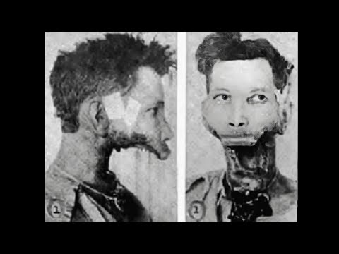 Faces Of Death-- The Agonizing Story Of Eben Byers