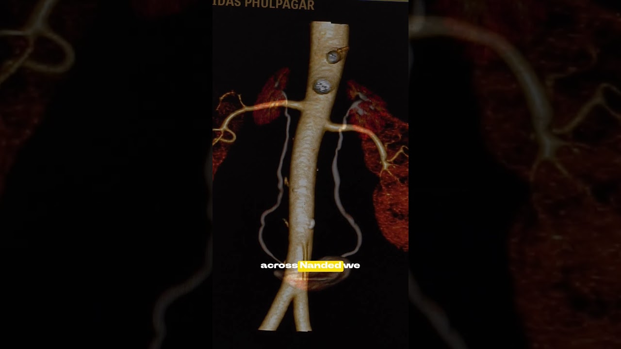 Discover the science behind better health at LifelineDiagnostic Centre.#bodycheckup#ctscan#radiology