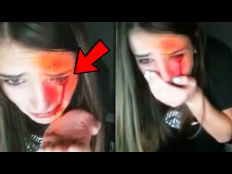 Top 5 Twitch Streamers THAT GOT INJURED LIVE!