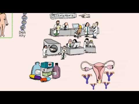 Preghiera di malattie articolazioni delle gambe Quali sono gli esercizi in video di osteocondrosi