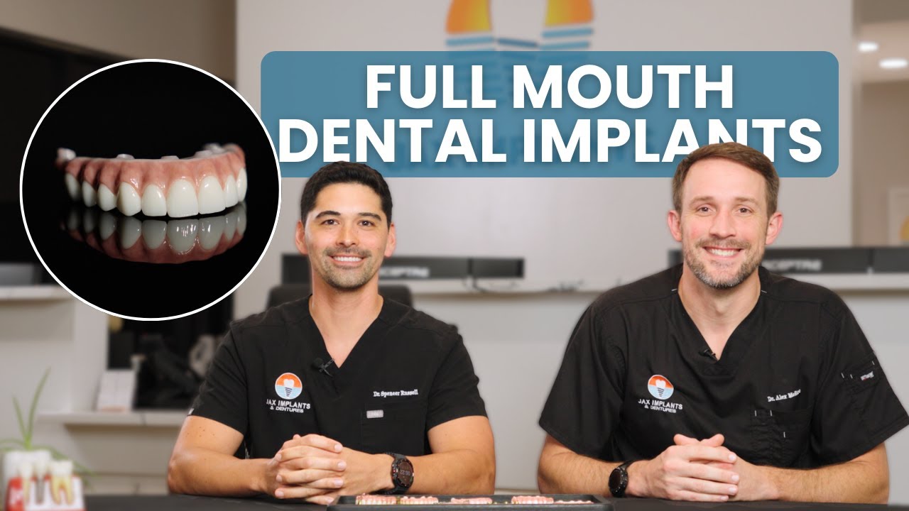Full Mouth Dental Implants: Everything You Need to Know and Cost