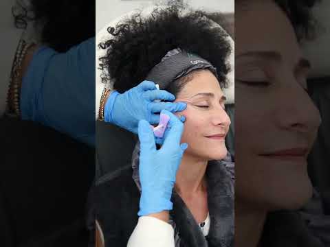 Ácido Hialuronico Facial - Carmen J Guerra