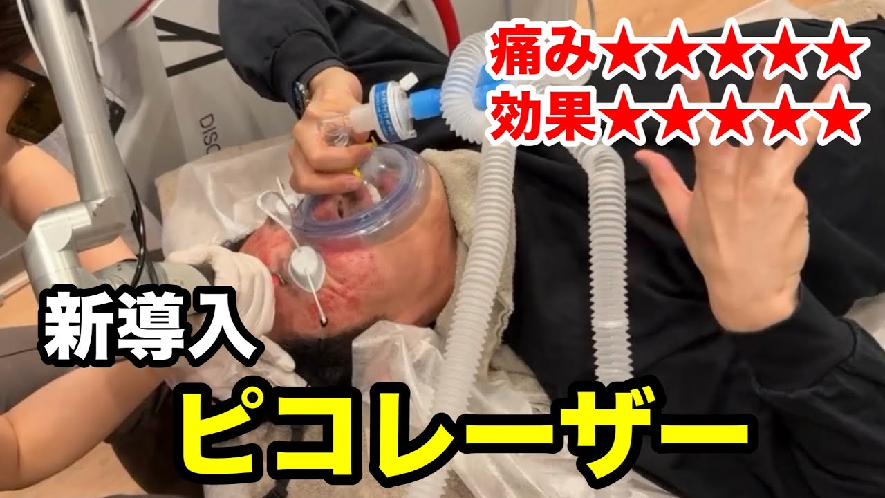 【3000万】新しく導入したピコレーザーの効果が凄すぎる‥