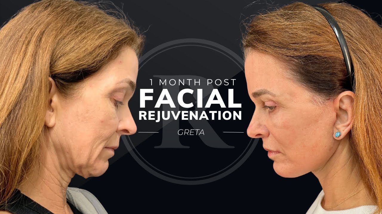 Robb Facial Plastic Surgery