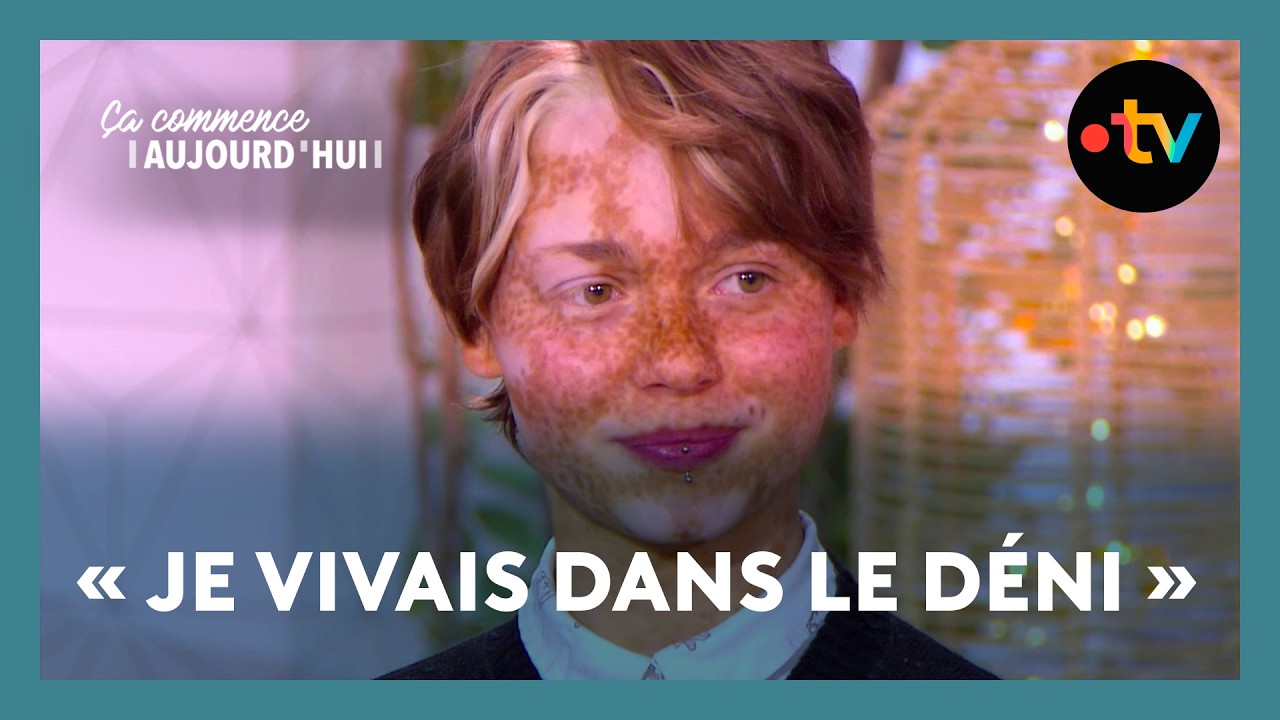 Choc émotionnel : Chloé a développé une hyperpigmentation puis un vitiligo - Ça commence aujourd'hui