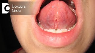 Why do I have pain at the back of my tongue? - Dr. Sriram Nathan