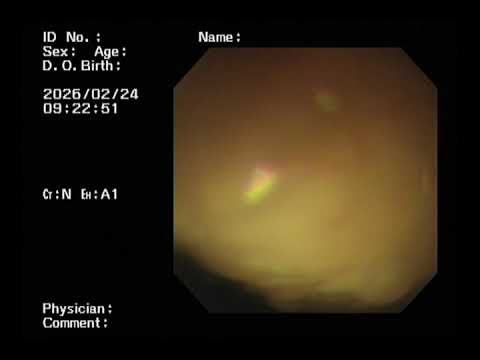 {{itemName}}_video_thumbnail