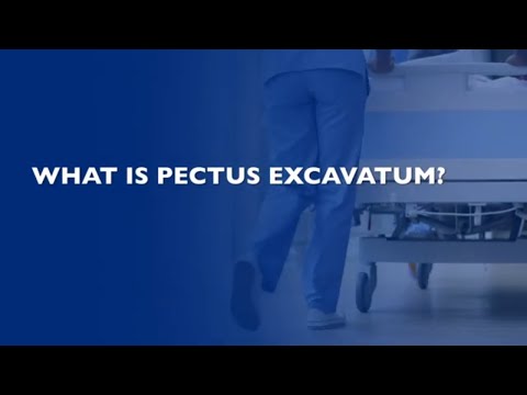 Pectus Excavatum Q&A