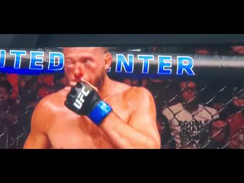 Donald Cerrone blows his nose - swollen eye