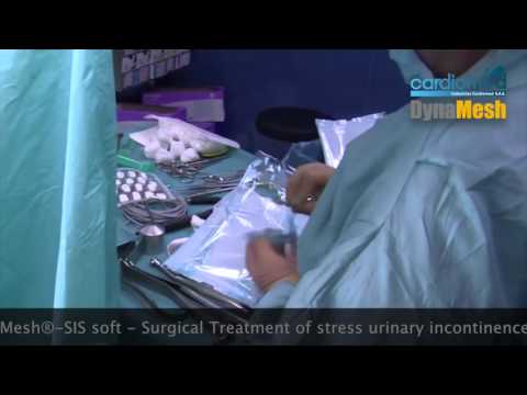 DynaMesh® SIS soft   Surgical Treatment of stress urinary incontinence in retrosymphyseal technique