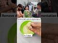 Heal Dark Spots Pigmentation With Tulsi Skincaretips Trending Facemask