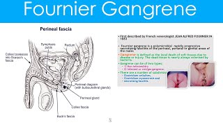 Fournier Gangrene causes,pathophysiology,features,diagnosis and treatment