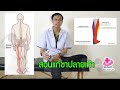 อาการ