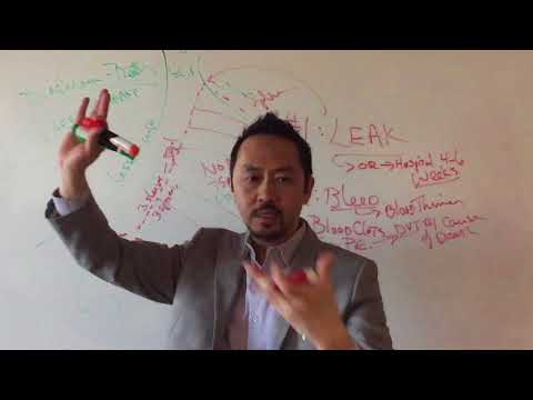 Dr. V Basics: "Possible Complications From Gastric Sleeve Surgery"