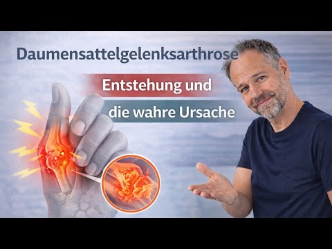 Daumensattelgelenksarthrose - Entstehung und die wahre Ursache
