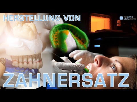 WIE UNSER LABOR ZAHNERSATZ HERSTELLT