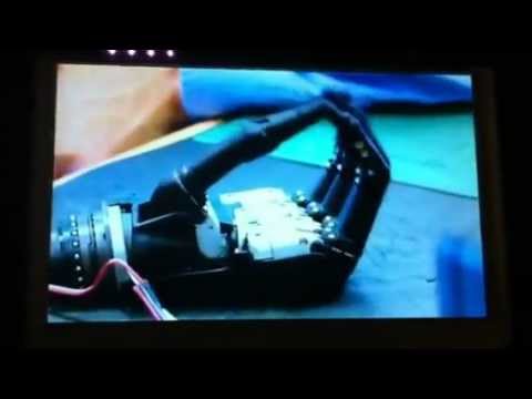 Chloe Holmes The Bionic Gurl on BBC's The One Show