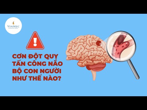 , title : 'Cơn đột quỵ não tấn công bạn như thế nào?| BS Nguyễn Thị Minh Phương, Bệnh viện ĐKQT Vinmec'