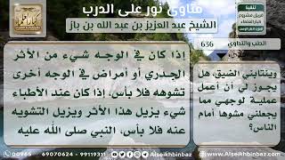 636 - حكم عملية التجميل لوجه الشاب إذا كان مشوهاً - نور على الدرب image