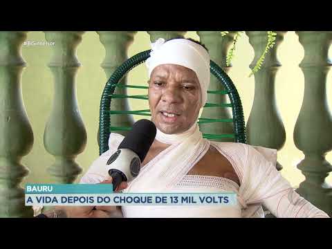 Eletricista que sofreu descarga elétrica de 13 mil volts em Bauru se recupera em casa
