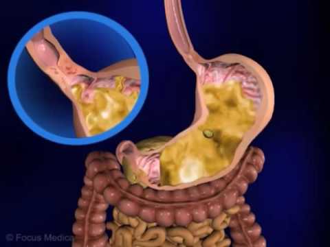 Unser Körper in 3D - Verdauunung und Ausscheidung (Schulfilm-Vorschau)