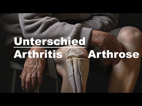 Arthrose und Arthritis | Unterschied