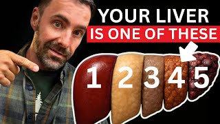 Your Liver Is SICK… But You Can Fix It Fast