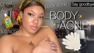 HOW TO GET RID OF BODY ACNE AND GET CLEAR SKIN FROM HEAD TO TOE USING THESE TIPS AND PRODUCTS ✨
