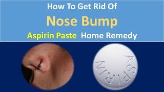 How to Get Rid Of Nose Bump | Aspirin Paste  Home Remedy