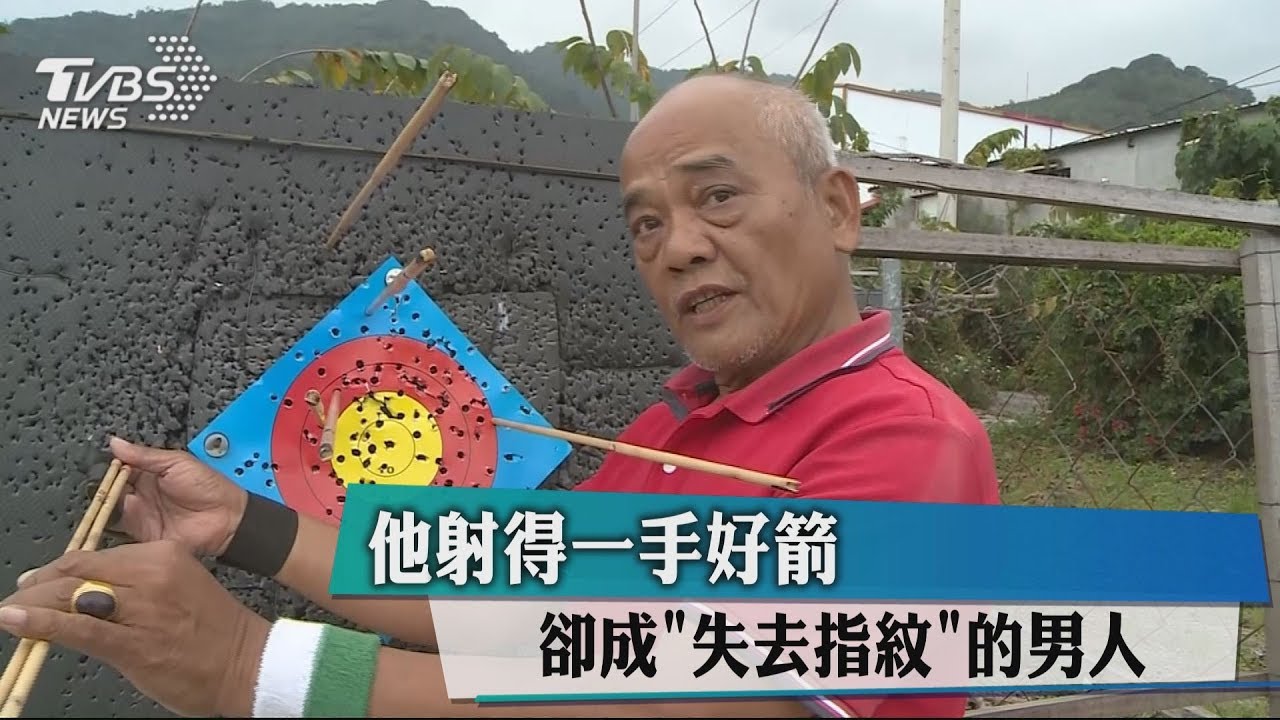 他射得一手好箭 卻成「失去指紋」的男人
