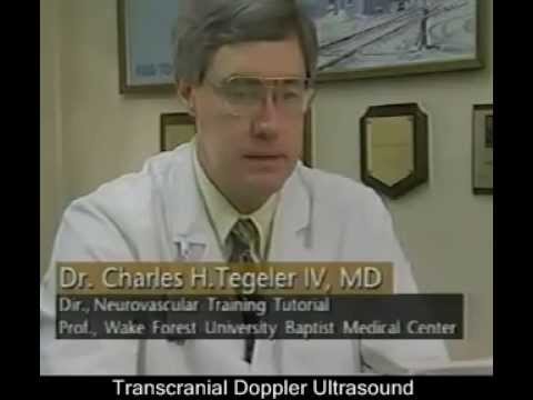 Transcranial Doppler Ultrasound Part 1 mp4  thJFYA0SsU online video cutter com
