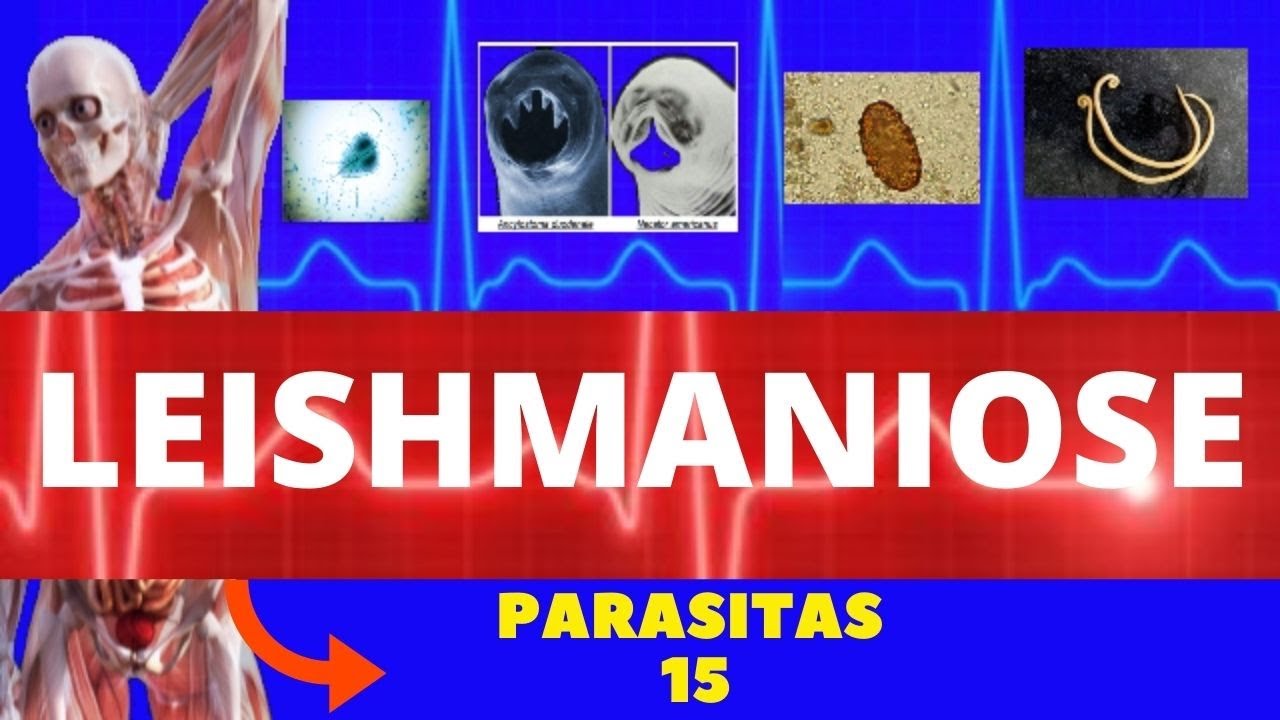 LEISHMANIOSE VISCERAL E LEISHMANIOSE TEGUMENTAR (LEISHMANIA SSP) - PARASITOLOGIA |INFECTOLOGIA