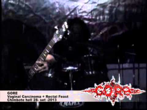 GORE - Vaginal Carcinoma + Rectal Feast chimbote 28 set 2013