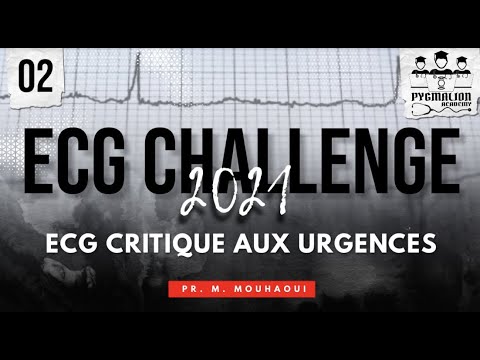 ECG CHALLENGE 2021_PART II