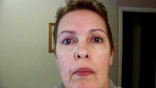 The Morning After....my 3rd Microdermabrasion and Glycolic Acid Peel