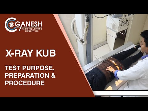 Röntgen-KUB – Testzweck, Vorbereitung und Durchführung bei Ganesh Diagnostic